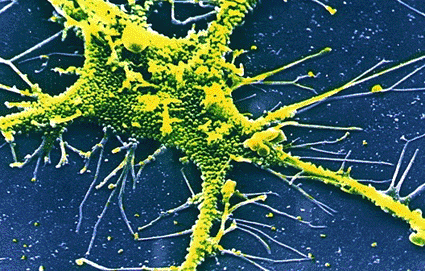 Image: False-color scanning electron micrograph (SEM) of a cell fibroblast infected with the Herpes Simplex Type I virus (photo courtesy of CNRI).